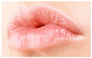 Acido hialuronico labios 2
