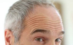 Ácido hialurónico y neuromodulación