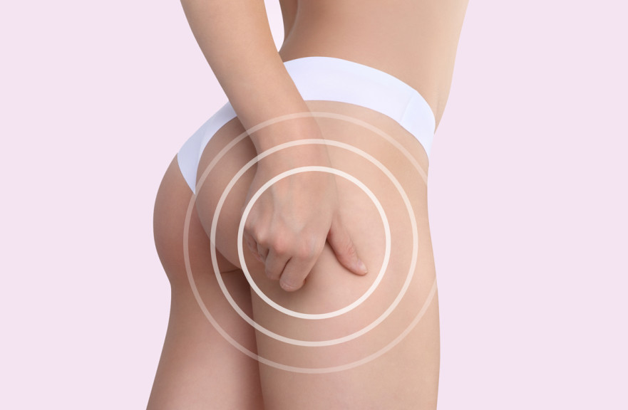 combatir la celulitis