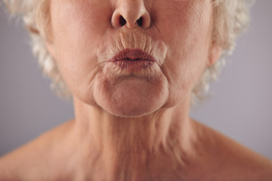 Arrugas en los labios